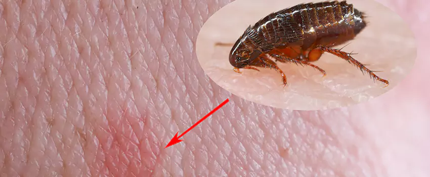 Flea Control for Humans El Cajon, CA